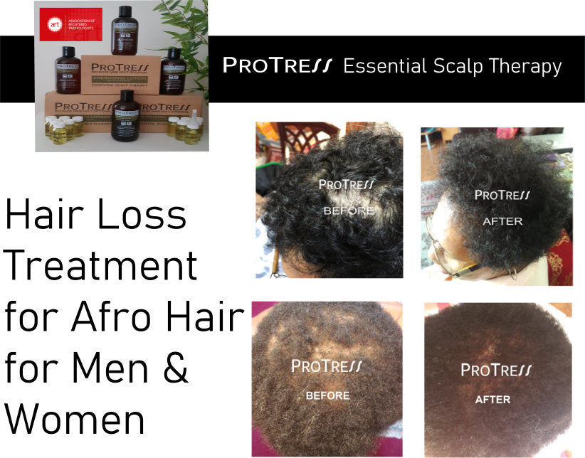 Hair Loss Treatment  Regena Roots  Hair Fall Solution